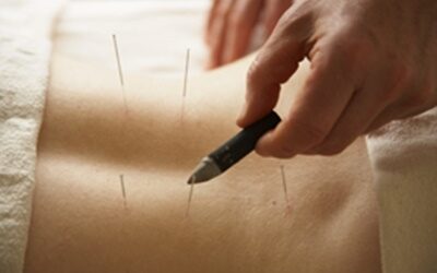 Acupuncture for Cancer